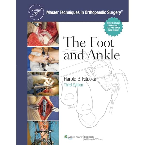Mann's Surgery of the Foot and Ankle, 2-Volume Set: Expert